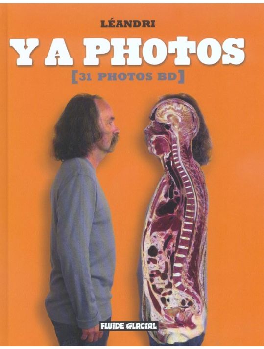 y a photos ; 31 photos bd main product photo